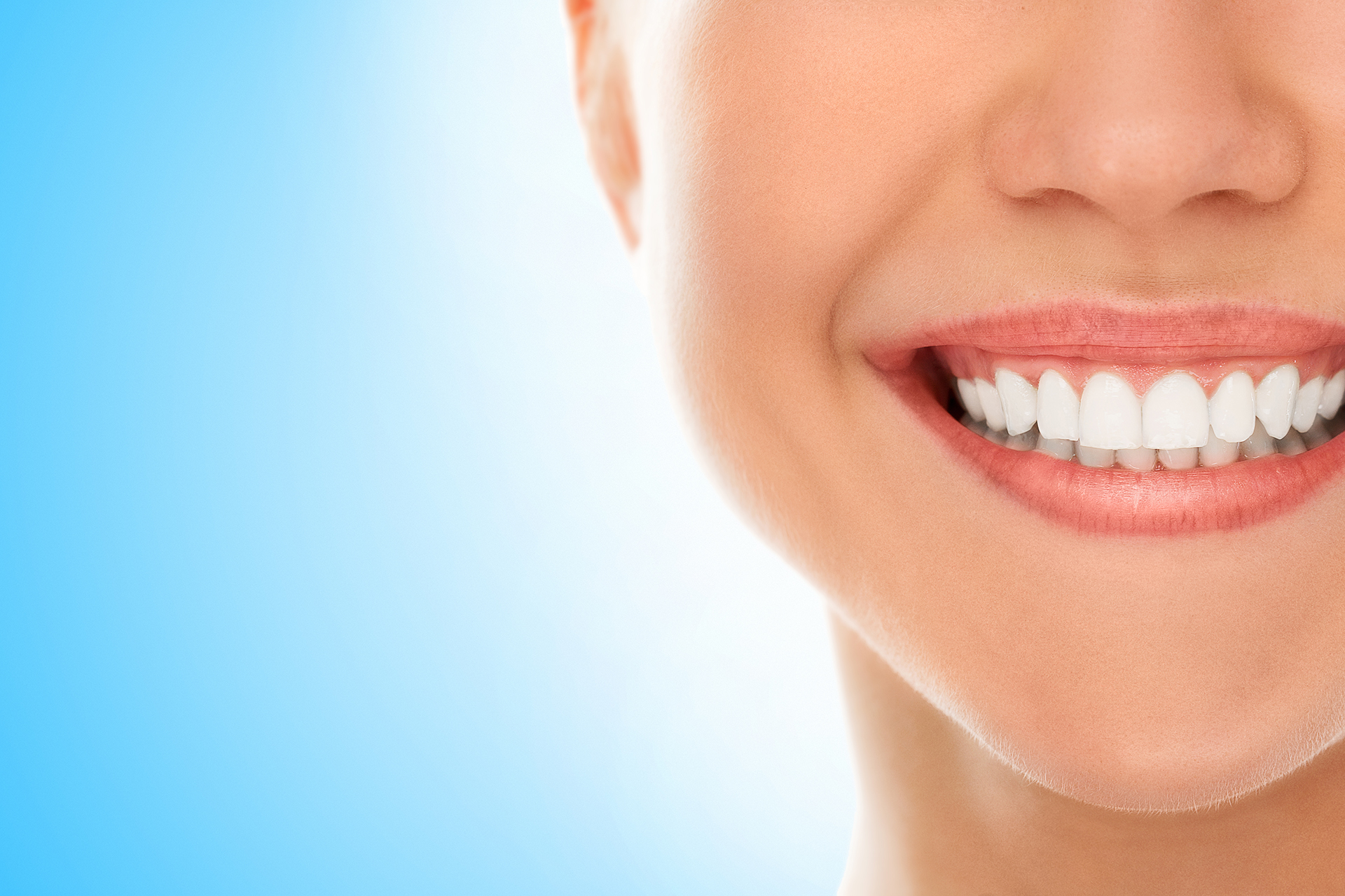 Reasons for Dental Veneer Damage